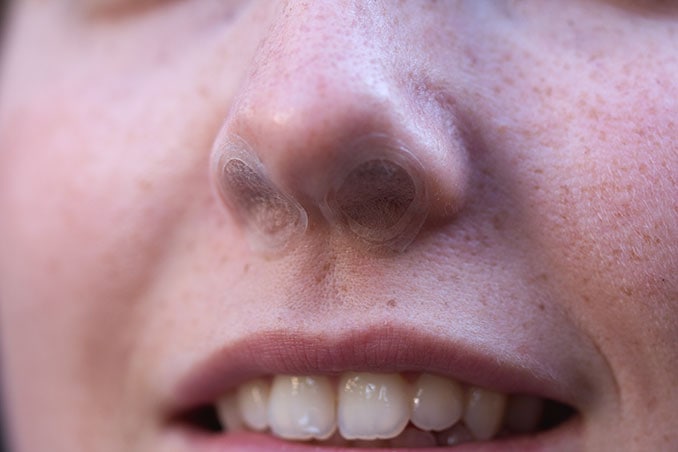 was-hilft-gegen-heuschnupfen-pollen-tierhaar-allergie-asthma
