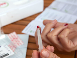 Bluttest Kosten online Aminogramm