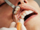 Zahnbehandlung im Ausland